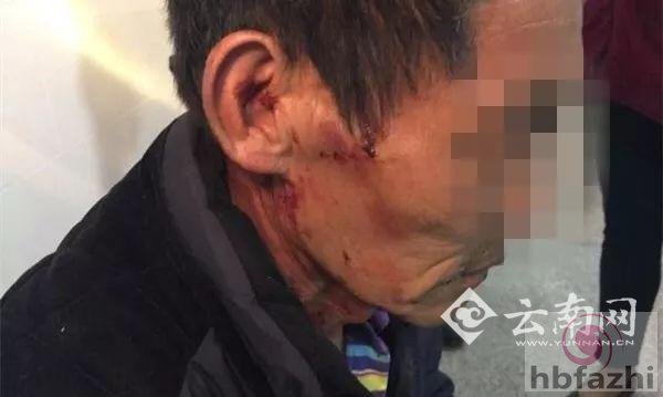 云南一男子多次酒后暴力殴打父母 警方：雷不劈你我们治